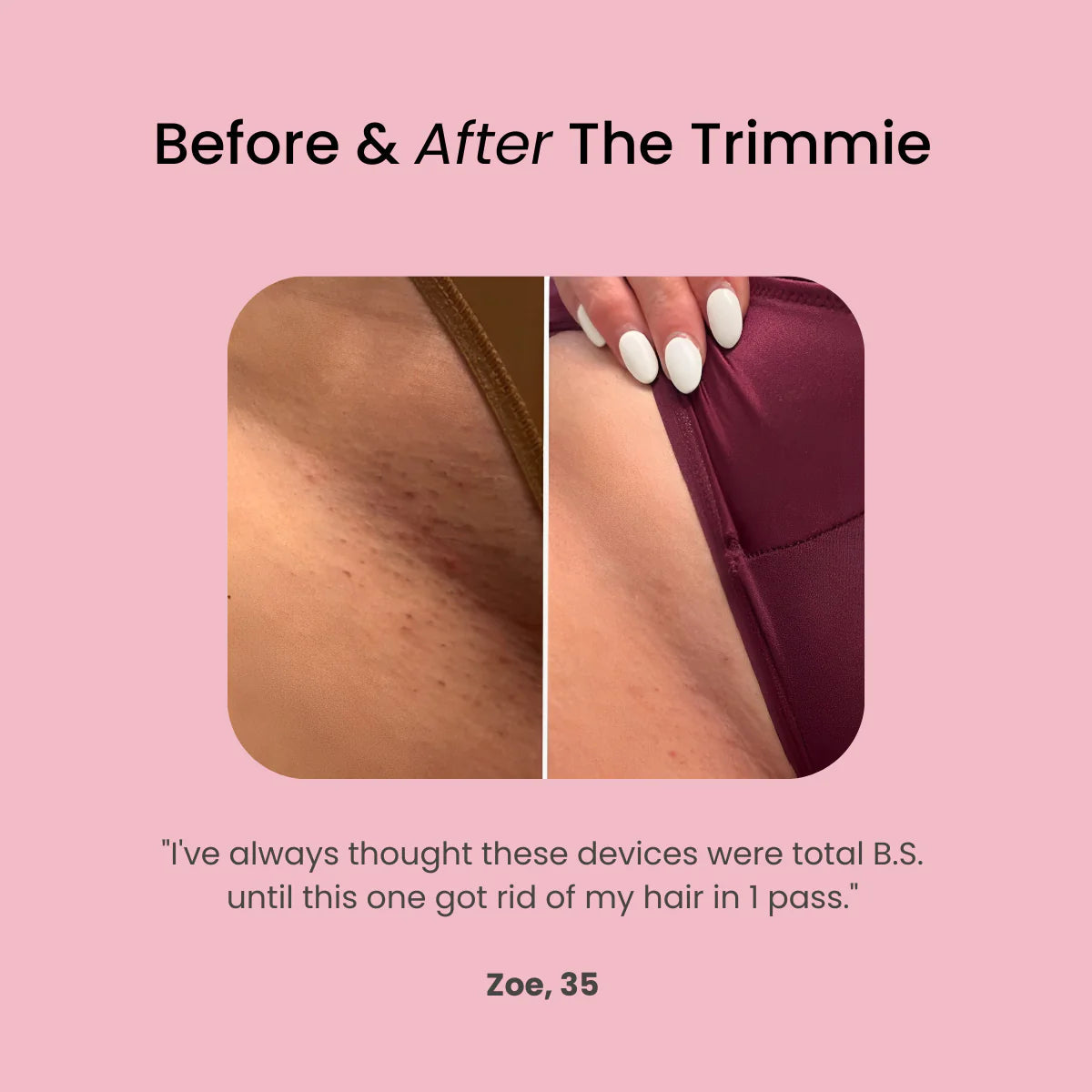 Nuvoran™ 2-in-1 Hair Trimmer