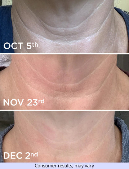 Neck Cream-Tighten & LiftFirming