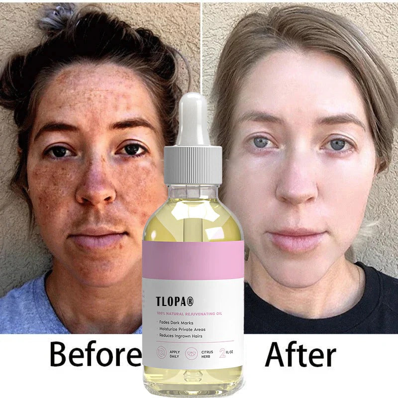 Quickly remove dark spots – moisturizes and removes ingrown hairs to infuse your skin with vitality and radiance.