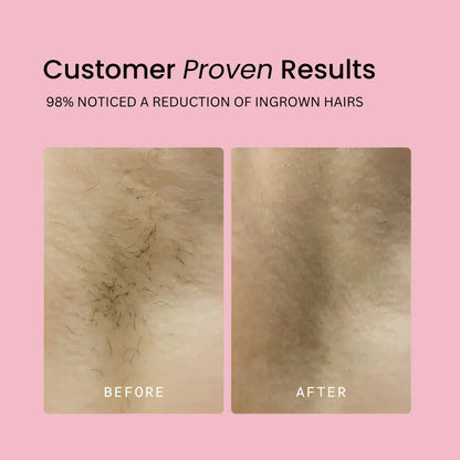 Nuvoran™ 2-in-1 Hair Trimmer